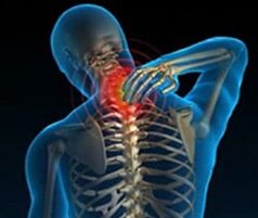 οστεοχόνδρωση της αυχενικής μοίρας της σπονδυλικής στήλης