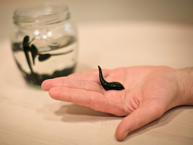 εφαρμογή για τη θεραπεία της αρθρώσεως της άρθρωσης του γόνατος